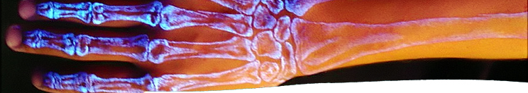 cyborg hand