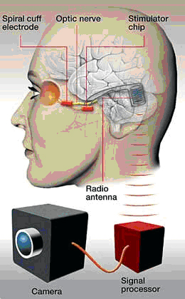 Optical Enhancement